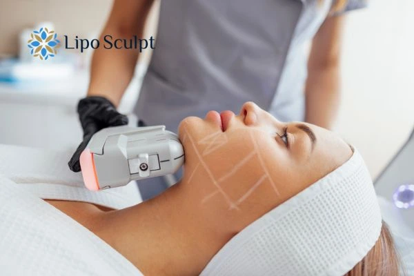 HIFU vs Botulinum Toxin: Understanding the Differences 1 HIFU vs Botox Worthing What is the best option for you?
