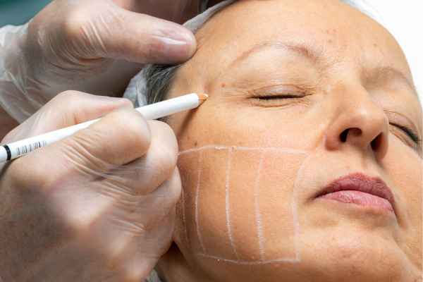 CryoPen: 5 Skin Concerns It May Be Used to Treat 4 What should you ask before having CryoPen treatment Worthing?