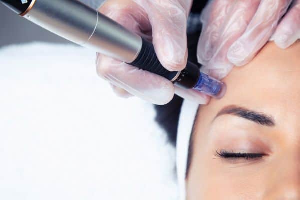 Explaining Total Skin Tightening Treatment and What to Expect 2 What Skin Concerns Can Total Skin Tightening Treatment Help With Worthing?